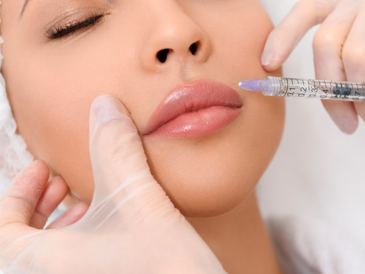 MY AESTHETICS – Experten für Lippen Aufspritzen Nürnberg