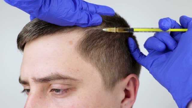 Haarausfall Nürnberg: Welche Therapien helfen wirklich?